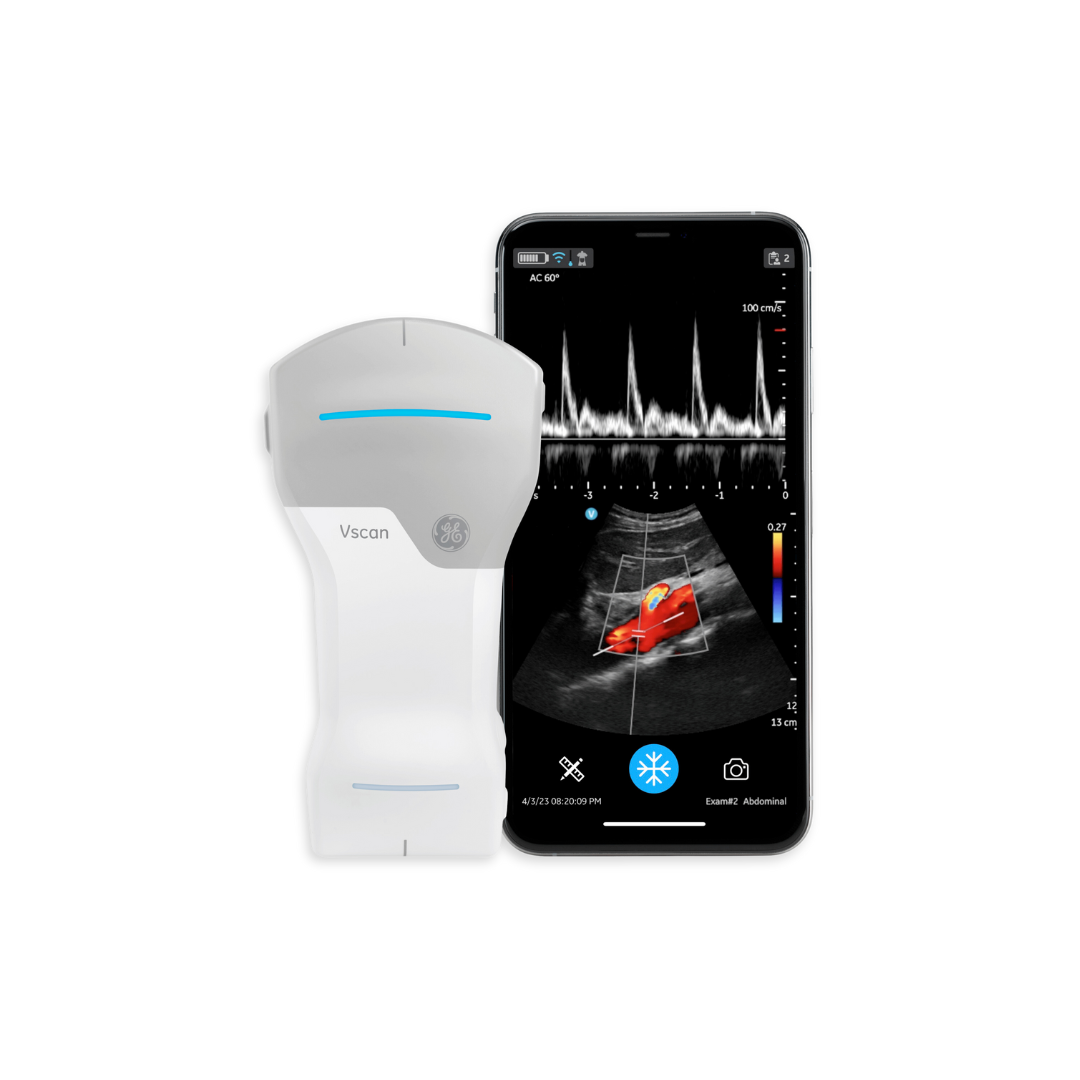 Vscan Rx Vscan Air and Radiesse + Bundle , Handheld Ultrasound
