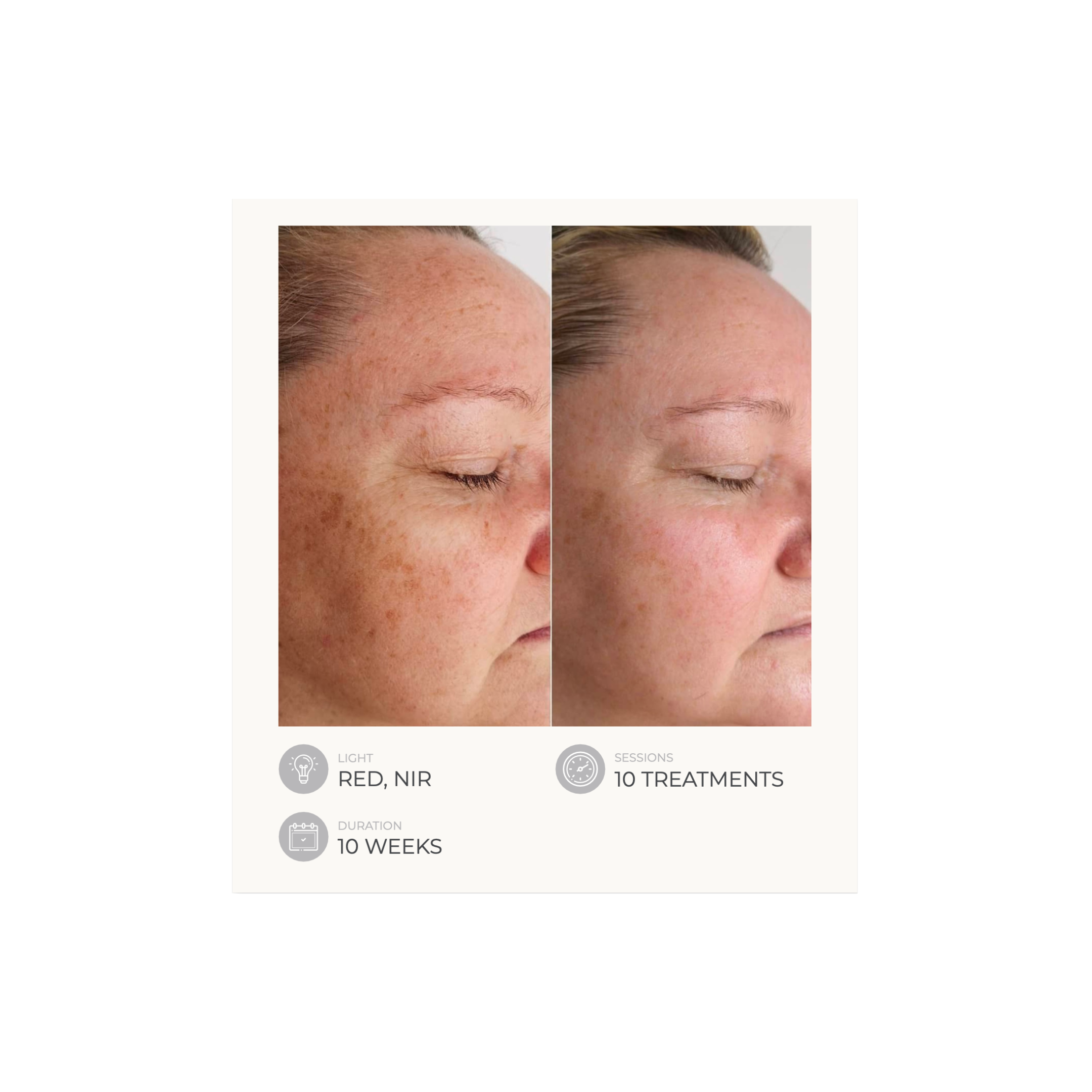 Dermalux Flex MD - Medical Grade LED Light Therapy Device