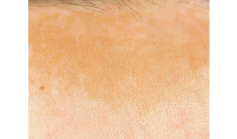 TXA Serum